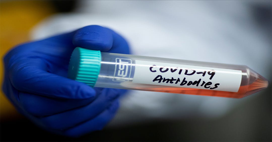 Antibody Testing for COVID-19: What You Need to Know